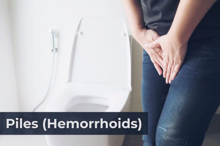 Piles Treatment in Jaipur: Laser, Symptoms & Cost | Health Point Hospital